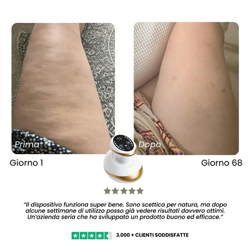 CelluFina™ - Anti Cellulite