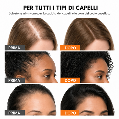 Il Siero Coreano N°1 per la Crescita dei Capelli