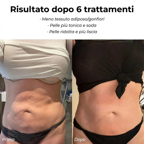 CelluFina™ - Anti Cellulite