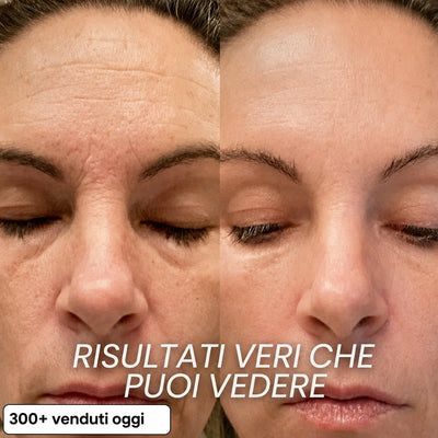 Stick Rimpolpante Bio-Collagene PDRN