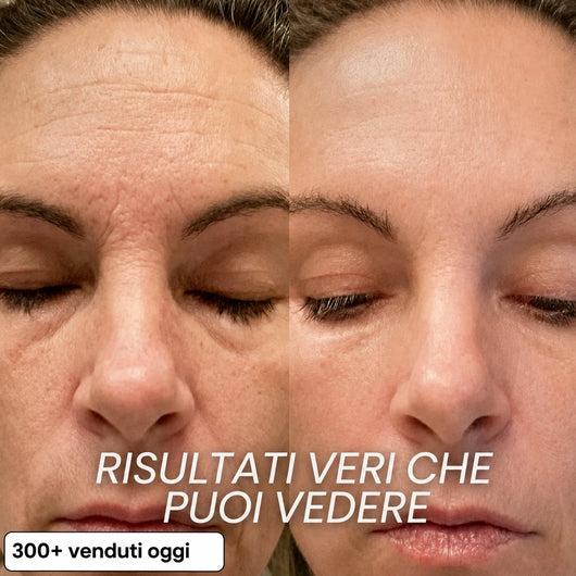 Stick Rimpolpante Bio-Collagene PDRN