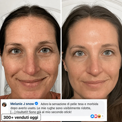 Stick Rimpolpante Bio-Collagene PDRN