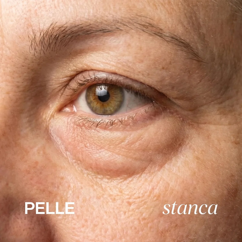 PELLE stanca